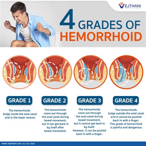 does gas aggravate hemorrhoids